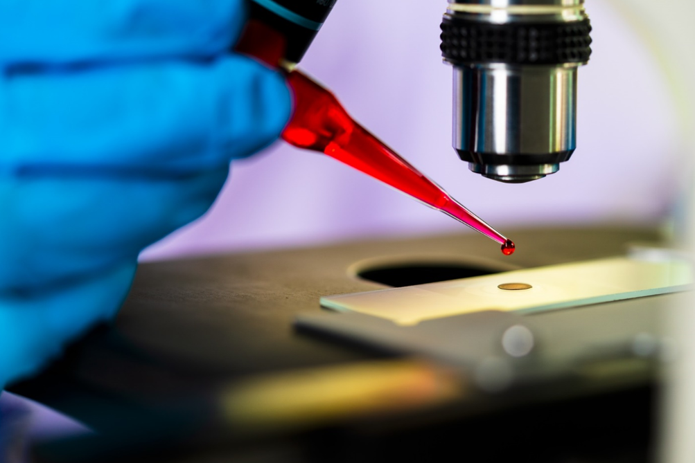 اکتشافات سلول های بنیادی پتانسیلی برای بهبود درمان سرطان 